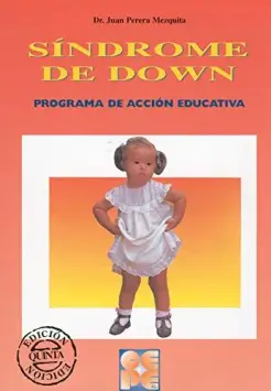 EL SNDROME DE DOWN